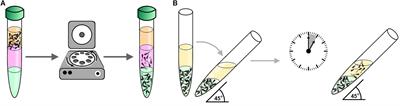 Novel Techniques of Sperm Selection for Improving IVF and ICSI Outcomes